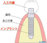 院内ラボ