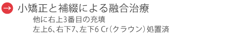 小矯正と補綴による融合治療